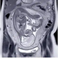 UCSF ObGyn Women’s Imaging 2025 (Videos + Slides PDFs)